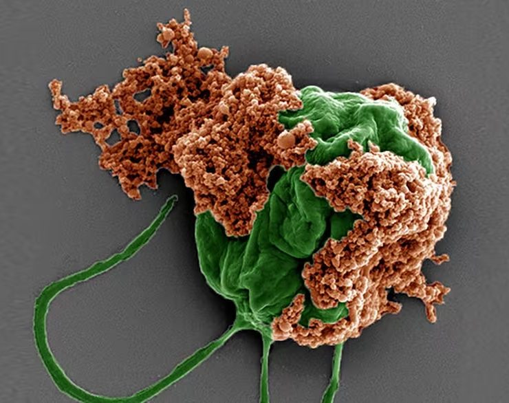 Crean micro robots para tratar el cáncer